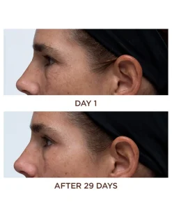 Cold Plasma Plus+ Eye| Perricone