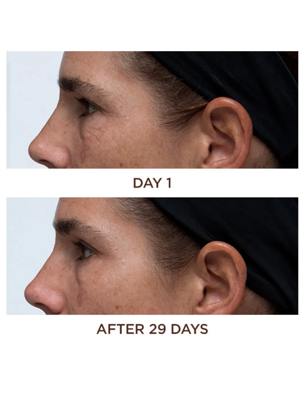 Cold Plasma Plus+ Eye| Perricone