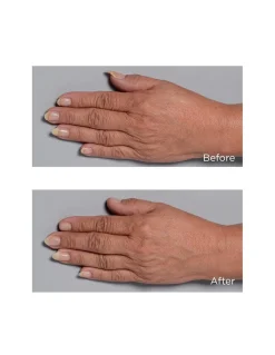 Cold Plasma Plus+ Hand Therapy | Perricone