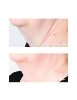 Cold Plasma Plus+ Sub-D/Neck | Perricone