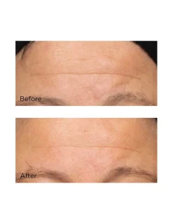 Cold Plasma Plus+ The Intensive Hydrating Complex | Perricone