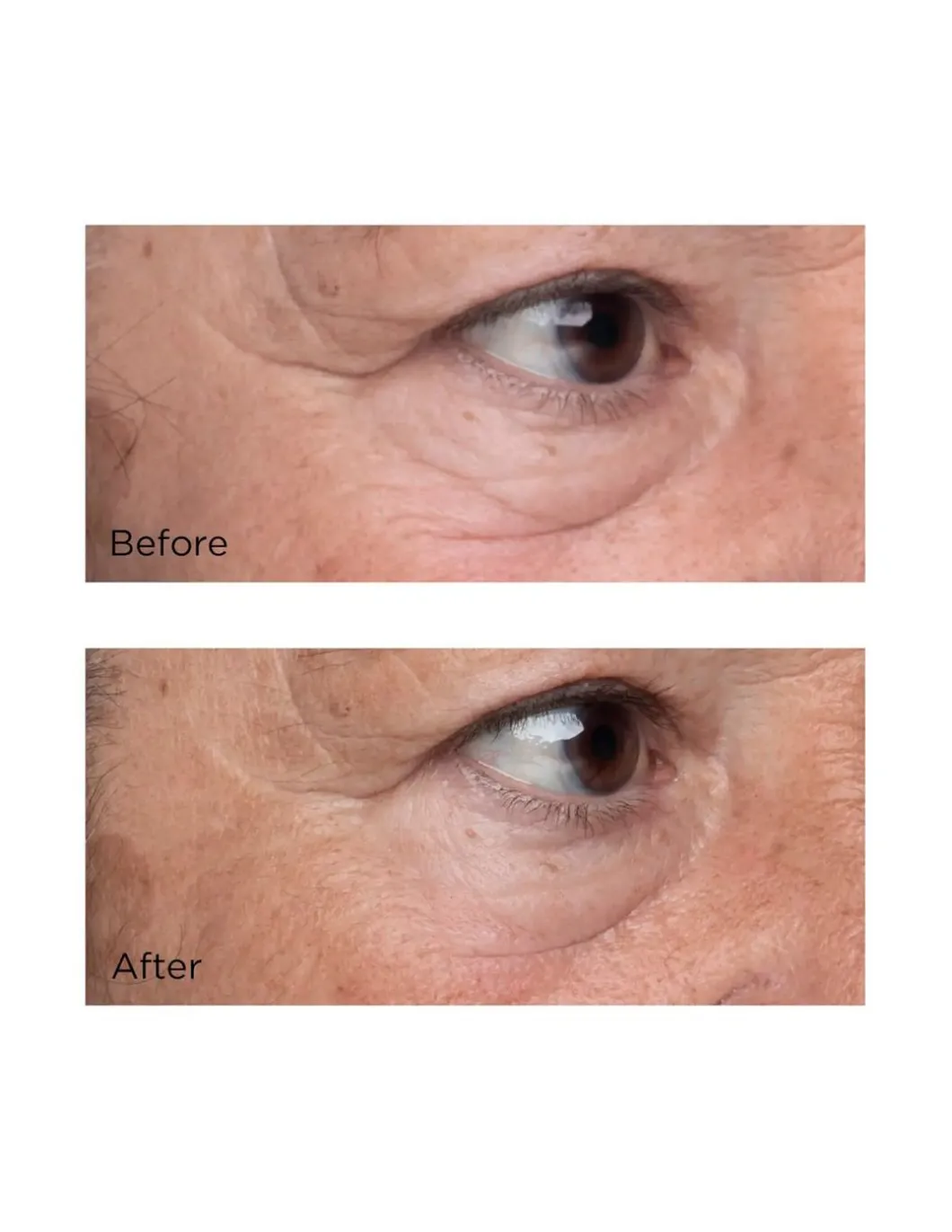 High Potency Growth Factor Firming & Lifting Eye Serum | Perricone