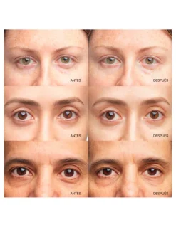 Perfumerías Coqueteo | All About Eyes Brightening Serum