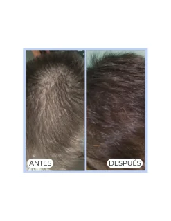 Perfumerías Coqueteo | Champú Shikakai Anticaída Y Caspa