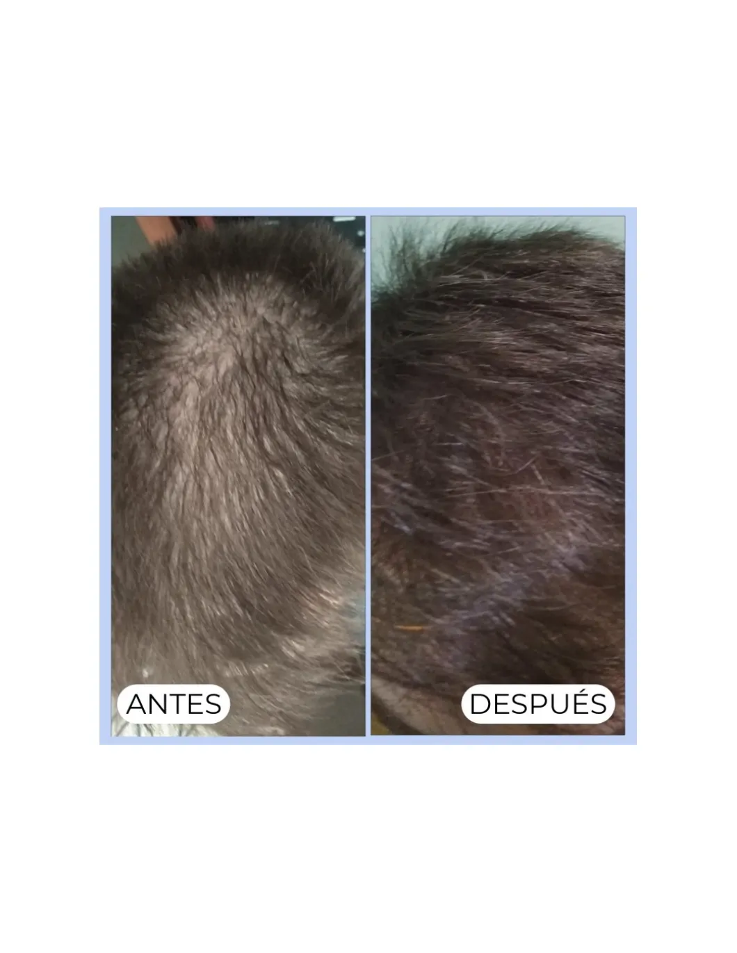 Perfumerías Coqueteo | Champú Shikakai Anticaída Y Caspa