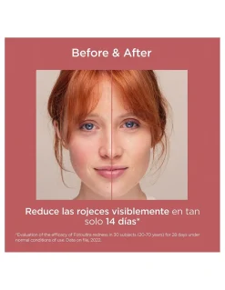 Perfumerías Coqueteo | FotoUltra Redness SPF 50+