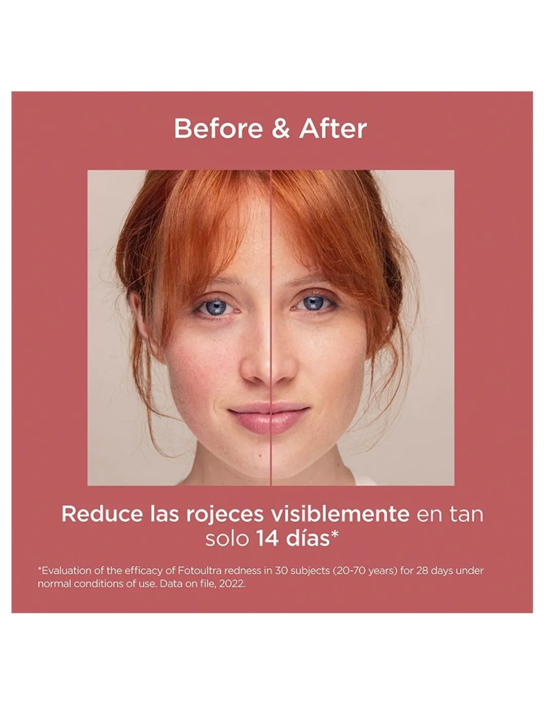 Perfumerías Coqueteo | FotoUltra Redness SPF 50+