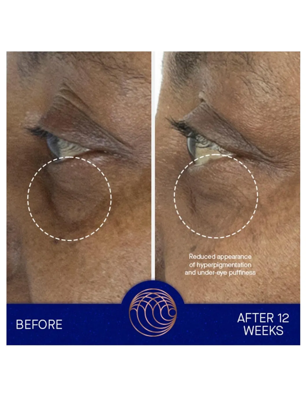 Perfumerías Coqueteo | The Eye Cream Full set